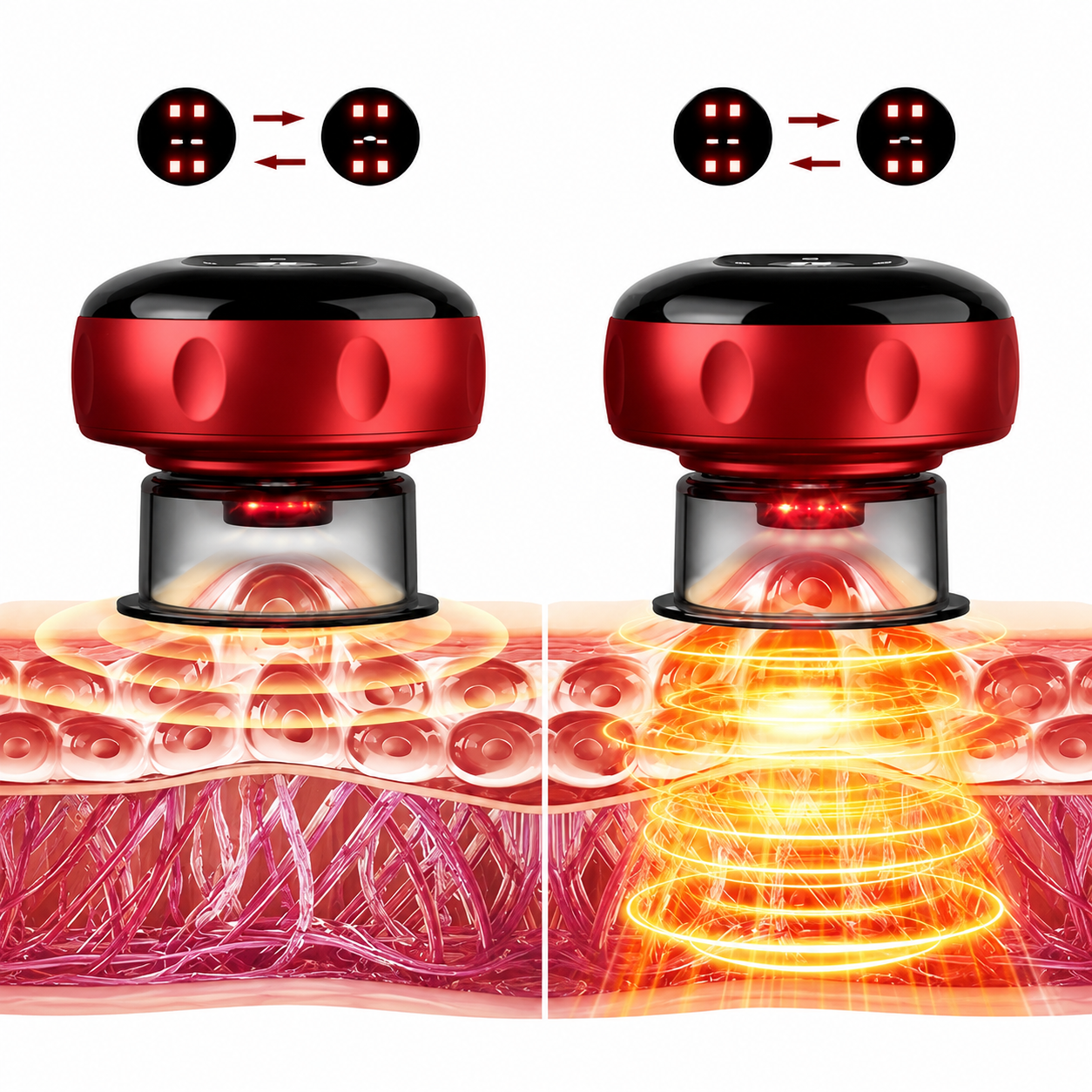 Cordia Smart Cupping Massager — Foot Pain Relief