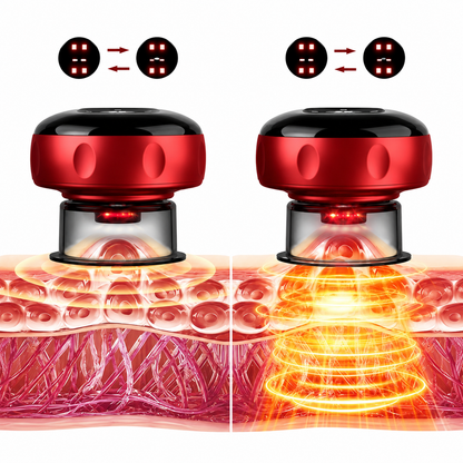 Cordia Smart Cupping Massager — Foot Pain Relief